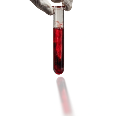 Blood Test